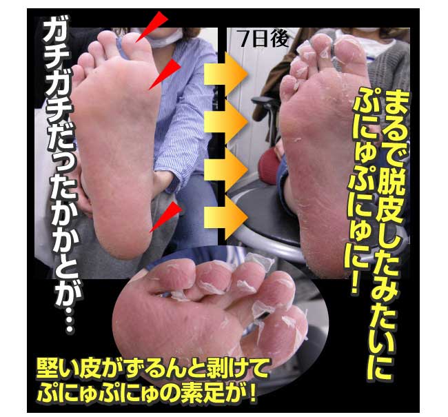 �_�b�s�[ �q�[�����O