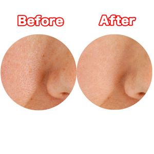 �|�A�~�j�}�j�X�g �t���b�g�J�o�[���G�b�Z���X�Z�b�g