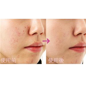 ビュレームモイストカバー&エイジデザイニングパウダー