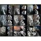 【スカルKR Medium Type 】 Keith Skull Ring キーススカルリング/Dice スカルKR88 20号