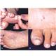 BabyFoot2ܥå ̿4