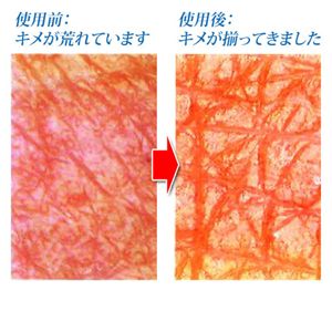 �r�[�o���W���A280�@M�@��pMK�I�E�S���p�b�N