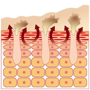 生毛穴パック