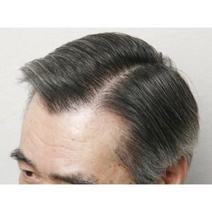 �{�����[���E�B�b�O�@�u���b�N