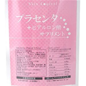 �X�L�����W�J���@�v���Z���^�T�v�������g3�Z�b�g