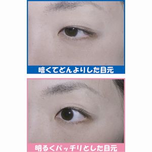 お家エステ・アイラッシュグローセット