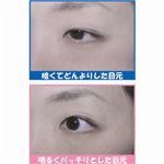 �A�C���b�V���O���[�Z�b�g