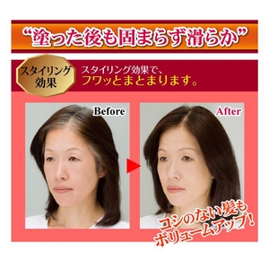 �V���K�l�[�[�@�|�C���g���b�`�J���[