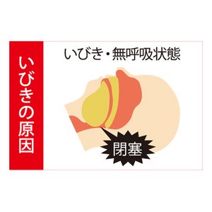 いびき防止グッズ NoiseSTOP(ノイズストップ) (2枚入り)