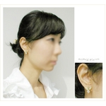 �V�g�̃I�[�o���V�F�C�v�s�A�X(�S�[���h)