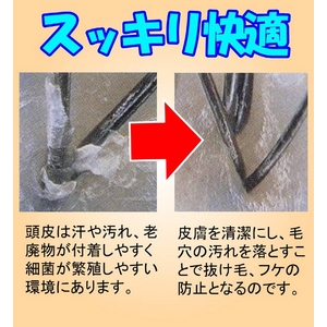 スカルプブラシ
