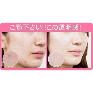 ���[�Y�A���G �a�a�N���[��