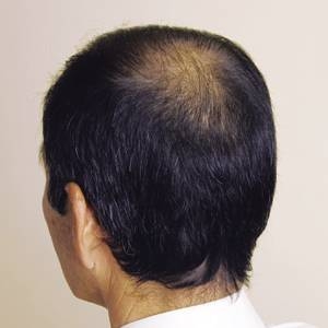 �����^�b�`�O���[�@3�{�Z�b�g