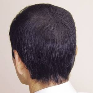 �����^�b�`�O���[�@3�{�Z�b�g