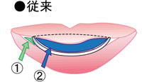 ののじ　離乳食スプーン