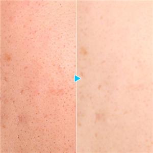 【箱つぶれ】フラットカバー