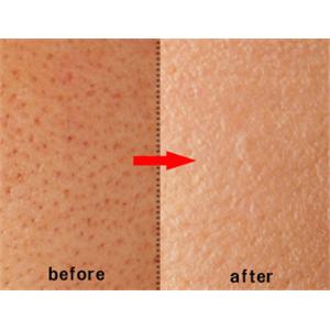 ビュレームカバーパウダー レフィル(コンパクトケース付)