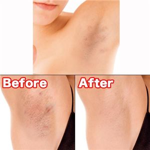 W/O�������åȥץ롼��