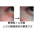 ＥＧＦ美容液（２個パック）「お試し版３ｍｌ×２」増量！！サイトカイン三種配合「スリーＧＦエッセンスＰｒｏ」