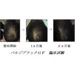 バルジブラックＧＦ　サイトカイン（細胞成長因子）配合増毛・育毛ヘアケア製品　２個パック