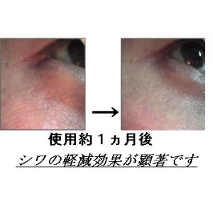 EGF・サイトカイン三種配合美容液 GFスリーエッセンス