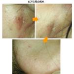 イヤーエステプロフェッショナル