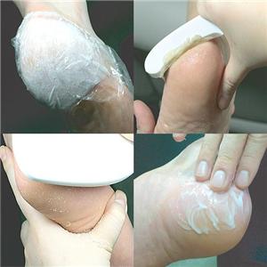 Pedix��Foot Peel