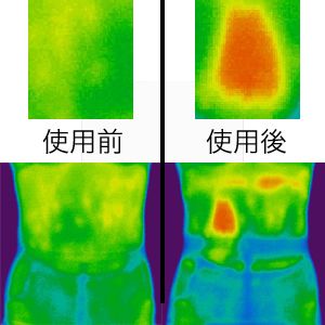 セルライトクラッシャー