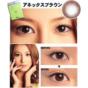 �G���W�F���J���[�E�A�l�b�N�X