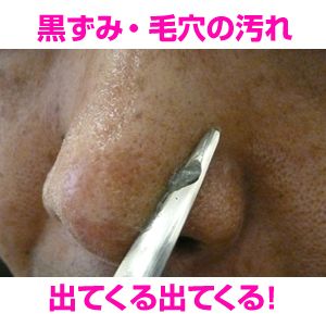 �v���`�i