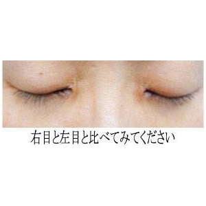 ܂уg[gg ACbVoh摜Q