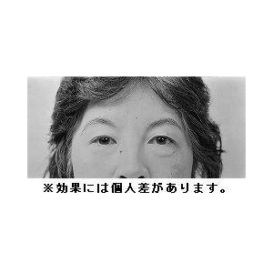 A_[g[gg@At@[bڂƐpet摜Q