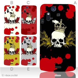 カラーA ハードケース IS11S／SO-02C Xperia Acro 対応 カバー ジャケット 携帯ケース is11s_a17_530a_a