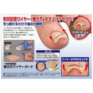 巻き爪ワイヤーガード