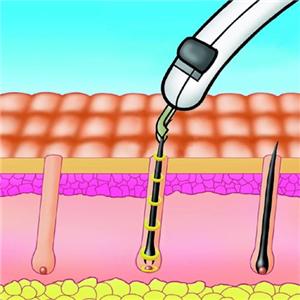 �G�s�C�I����